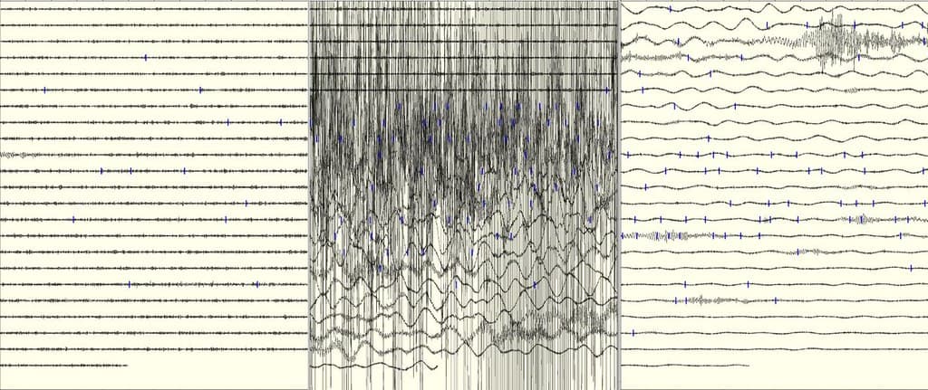 Înregistrare grafică a unor unde seismice pe hârtie, asemănătoare unei seismograme. (Foto de arhivă: uair01 / BY 2.0, Openverse)