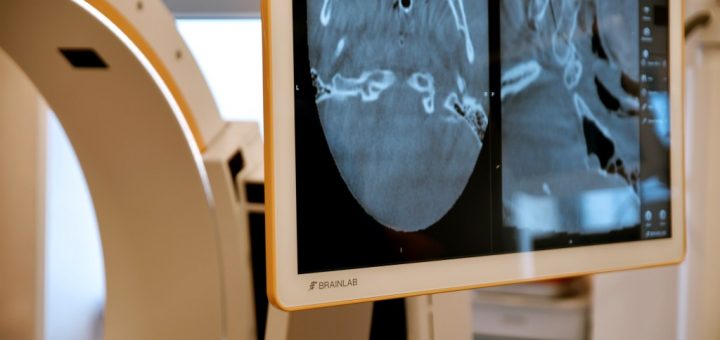 HOTNEWS.RO: „Orice mișcare bruscă sau căzătură îmi punea viața în pericol.“ Cum a fost salvată o pacientă de la paralizie de o echipă de neurochirurgi de la Spitalul MedLife Humanitas printr-o abordare îndrăzneață și inovatoare