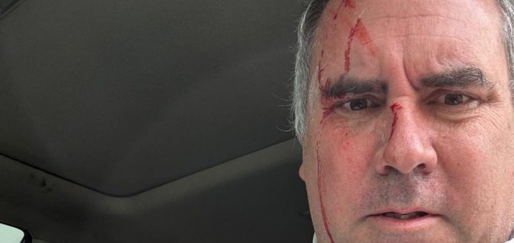 HOTNEWS.RO: Tentativă de asasinat asupra unui candidat la prezidențialele din Peru. „Un început prost de campanie”