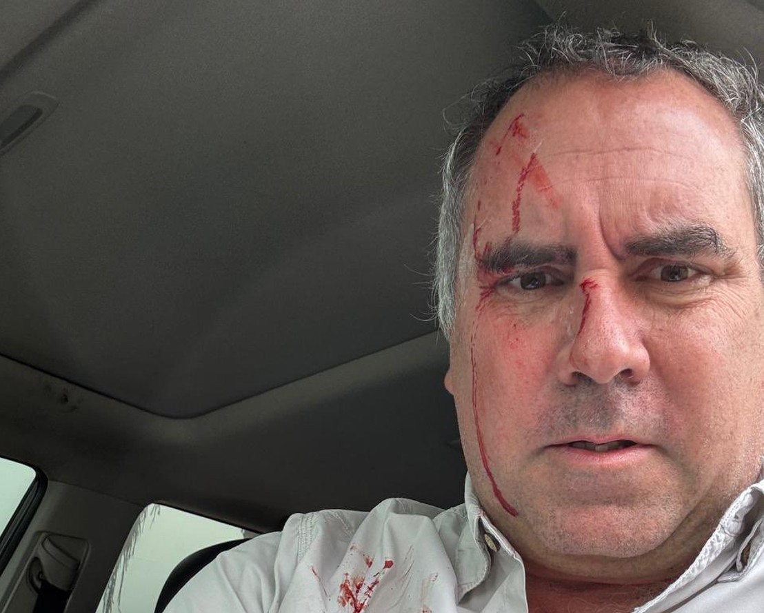 HOTNEWS.RO: Tentativă de asasinat asupra unui candidat la prezidențialele din Peru. „Un început prost de campanie”