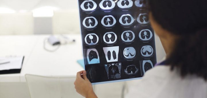 HOTNEWS.RO: Prințesa Mette-Marit a fost supusă unui transplant pulmonar la 13 zile după ce a fost pusă pe lista de aștepare