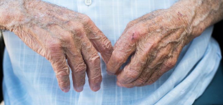 HOTNEWS.RO: Un bătrân de 92 de ani a ajuns la spital cu arsuri după ce a verificat butelia cu chibritul